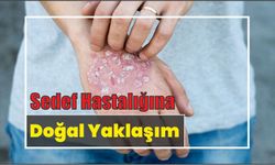 Sedef Hastalığına Doğal Yaklaşım