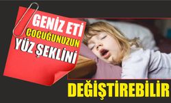 GENİZ ETİ ÇOCUĞUNUZUN YÜZ ŞEKLİNİ DEĞİŞTİREBİLİR