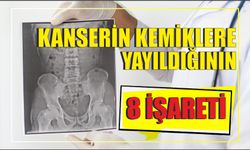 KANSERİN KEMİKLERE YAYILDIĞININ 8 İŞARETİ