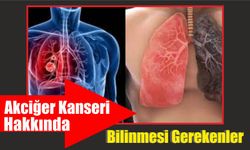 Akciğer Kanseri Hakkında Bilinmesi Gerekenler