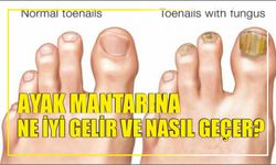 Ayak Mantarına Ne İyi Gelir ve Nasıl Geçer?