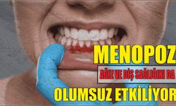 Menopoz ağız ve diş sağlığını da olumsuz etkiliyor