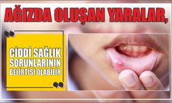 Ağızda oluşan yaralar, ciddi sağlık sorunlarının belirtisi olabilir