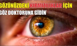 Gözünüzdeki kırmızılıklar için göz doktoruna gidin