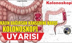 Kalın Bağırsak Kanserine Karşı Kolonoskopi Uyarısı