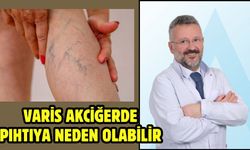 Varis Akciğerde Pıhtıya Neden Olabilir