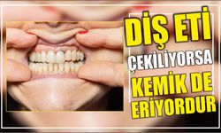 Diş eti çekiliyorsa kemik de eriyordur