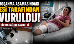Boşanma aşamasındaki eşi tarafından vurulan kadın bir bacağını kaybetti