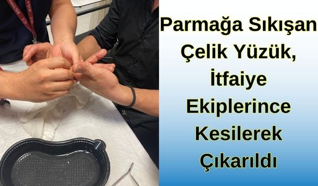 Parmağa Sıkışan Çelik Yüzük, İtfaiye Ekiplerince Kesilerek Çıkarıldı