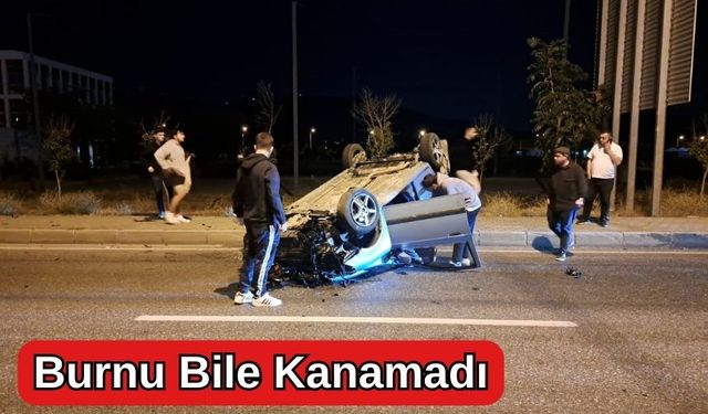 Burnu Bile Kanamadı