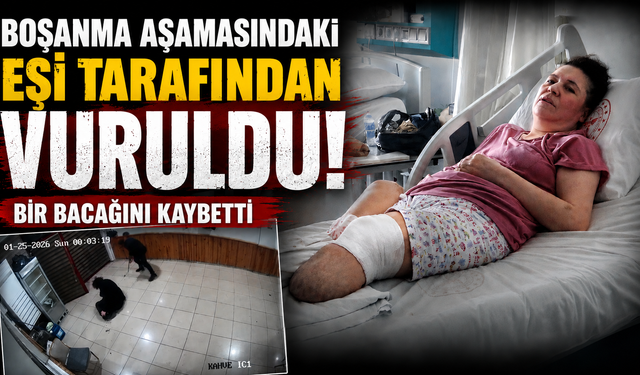 Boşanma aşamasındaki eşi tarafından vurulan kadın bir bacağını kaybetti