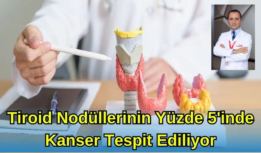 TİROİD NODÜLLERİNİN %5’İNDE KANSER TESPİT EDİLİYOR